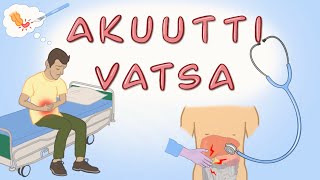 Akuutti vatsa [upl. by Aynod]