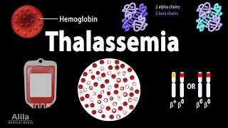 Thalassemia Alpha amp BetaThalassemias Genetics Pathophysiology Diagnosis amp Treatment Animation [upl. by Acenahs622]