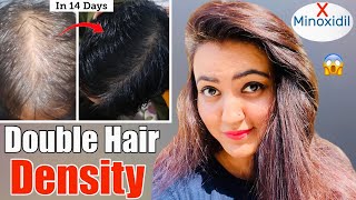 14 Days Challenge  Try This Hair Growth Remedy To Get Double Hair Density amp Thick Long Hair❤️ [upl. by Calista]