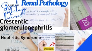 crescentic glomerulonephritis  renal pathology  nephritic syndrome  Drsamcrest [upl. by Weissberg]