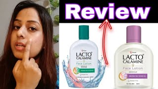 Lacto Calamine face Lotion Review  How To Use lacto Calamine Lotion skfashionlifestyle [upl. by Onder]