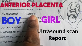 Anterior Placenta Baby GenderUltrasound Scan Report [upl. by Amaty865]