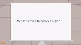 What is the Dalrymple sign [upl. by Virendra]