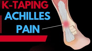 How to treat Achilles pain  tendonitis using Kinesiology taping techniques [upl. by Cherri984]