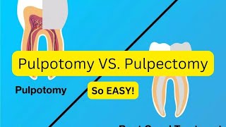 Difference between pulpotomy and pulectomy and STEPS [upl. by Neala]