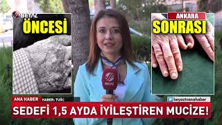 Sedefi bir buçuk ayda iyileştiren mucize [upl. by Tove]