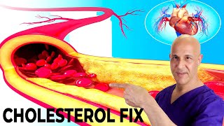 The Most Effective Way to Lower Your Cholesterol Naturally in 7 Days Dr Mandell [upl. by Benedikta]