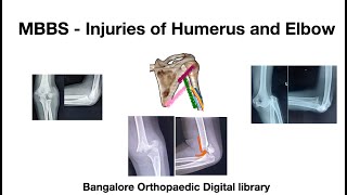 MBBS  Humerus and Elbow injuries [upl. by Baalman]