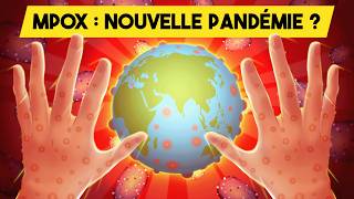 MPOX  La PROCHAINE pandémie   Variole du singe  Monkeypox [upl. by Aietal]