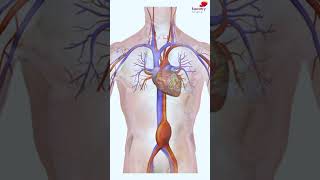 What are the Types of Cardiac Surgeries  Watch Full Video  httpsyoutube9sKmEVwx9Q [upl. by Thetis477]