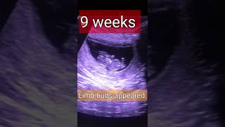 Pregnancyweekbyweek 5 15 weeks shortvideo shorts [upl. by Nikolia]