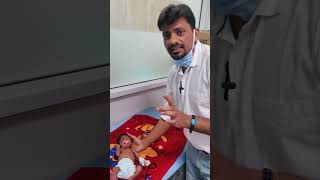 polydactyly syndactyly and dolichocephaly  a case demonstration [upl. by Naol]