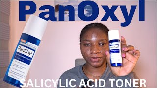 Panoxyl Salicylic Acid Toner Review  Acne treatment whiteheadsblackheadsexfoliate [upl. by Katrinka804]