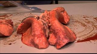 Lung inflation in HD video [upl. by Hasila]