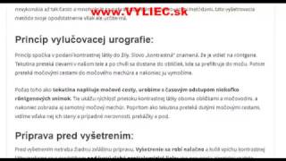 Vylučovacia urografia [upl. by Il393]