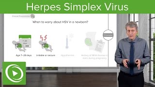 Febrile Baby Herpes Simplex Virus – Pediatrics  Lecturio [upl. by Adnaugal]