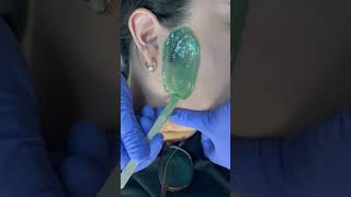 Professional sideburn wax performed by me Using Nacach hard green wax esthetician waxing [upl. by Damahom]