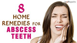 8 Home Remedies for Abscess Teeth [upl. by Fruin23]