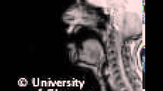 MRI voiceless labiodental fricative [upl. by Auhsej]