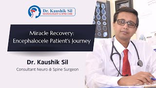 Miracle Recovery Encephalocele Patients Journey  Dr Kaushik Sil [upl. by Lewan80]