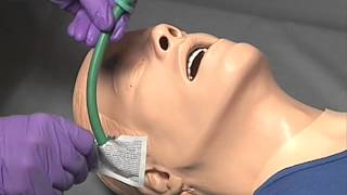 EMS Skills  Nasopharyngeal Airway Insertion [upl. by Iatnwahs]