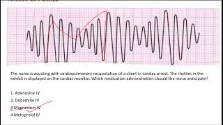 NCLEX QUESTIONS ON ECG ANALYSIS AND INTERPRETATION [upl. by Joshuah]