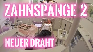 Zahnspange Teil 2  Neuer Zahnbogen  2016  Emma Sophie [upl. by Kalindi]