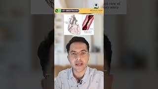 What is CABG Surgery   CABG Surgery in India [upl. by Brig]