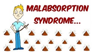 Malabsorption Syndrome [upl. by Toolis]