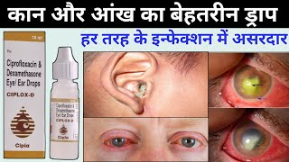 ciplox d eye ear drops  ciprofloxacin dexamethasone eye ear drops ciplox d uses in hindi [upl. by Mervin]