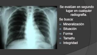 Fundamentos para Interpretación en Radiología General Simple [upl. by Ahseiyk]