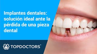 ¿Cómo se ponen los Implantes Dentales Paso a Paso 🔩 ¿Duelen  Odontología Láser [upl. by Stein]