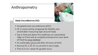 Anthropometry Measurements in Newborn  Pediatrics [upl. by Royden]