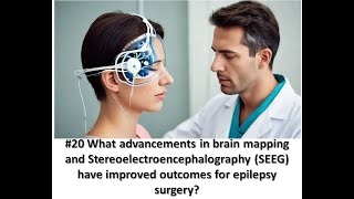 20 What advancements in brain mapping and Stereoelectroencephalography SEEG have improved outcome [upl. by Leahcimluap]