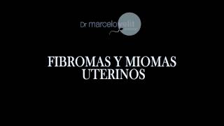 FIBROMAS Y MIOMAS UTERINOS [upl. by Ybrad]