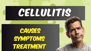 Cellulitis  causes  symptoms  treatment   general practice [upl. by Nevla]