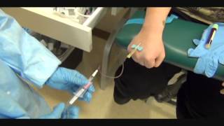 Butterfly Hand Phlebotomy Outside Vein Activationwmv [upl. by Nanette]