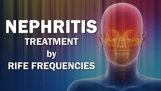 Nephritis  RIFE Frequencies Treatment  Energy amp Quantum Medicine with Bioresonance [upl. by Nnaira]