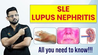 What is Lupus Nephritis  लुपस नेफ्रायटीस क्या है  जानिए इसके लक्षण  कारन  निदान  दवाइयाँ [upl. by Ative]