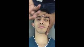 Facial palsy Rehabilitation practical [upl. by Ecnar103]