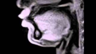 Live video of movements during speech production MRI at 20 ms [upl. by Wynn]