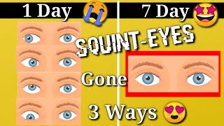 Squint Eye correction NATURALLY with exercises at Home [upl. by Adolfo]