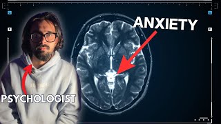 चिंता और तनाव से राहत Tools for Anxiety and Stress Relief The Hypno Guy [upl. by Victory868]