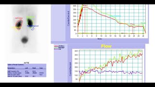 Renal scintigraphy Radiopharmaceuticals MCQ RenalScintigraphy renal scfhs nuclearmedicineMCQ [upl. by Dnomaid]