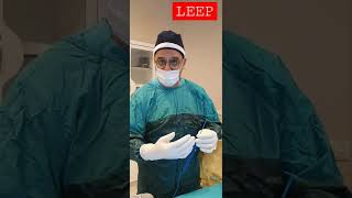 LEEP 💥 Loop Electrosurgical Excision Procedure [upl. by Georgy]