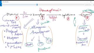 Homocystinuria explained clear and easy vs marfans [upl. by Cory]