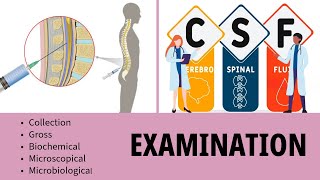 CSF Examination  Cerebrospinal Fluid  Collection  Gross  Biochemistry  Microscopy [upl. by Arriek626]