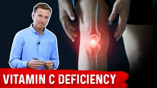 Could Your Joint Pain Be a Vitamin C Deficiency – DrBerg [upl. by Wartow]