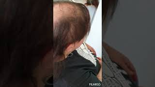 Mesh Integration System Non Surgical Hair Replacement [upl. by Seitz]