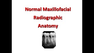 Normal Maxillofacial Radiography Anatomy Maxilla [upl. by Ajnotal]